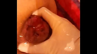 936 gay fisting porn videos